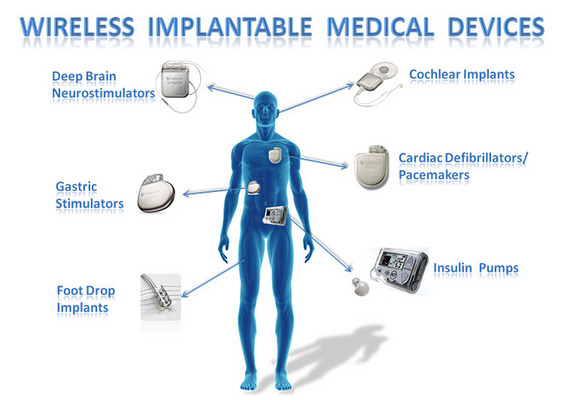importare dispositivi medici Stati Uniti registrazione 510K FDA
